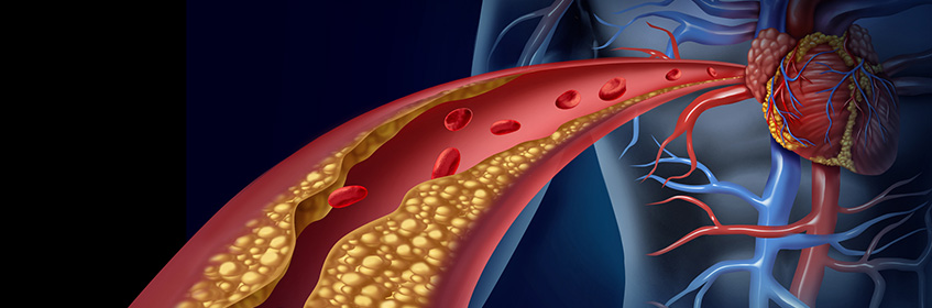 Cholesterol